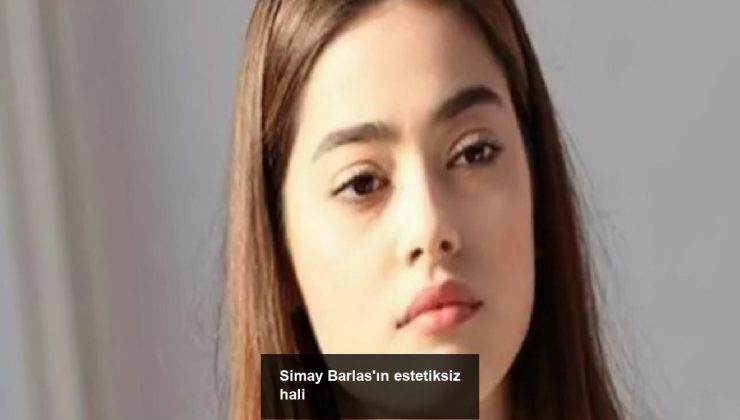 Simay Barlas’ın estetiksiz hali