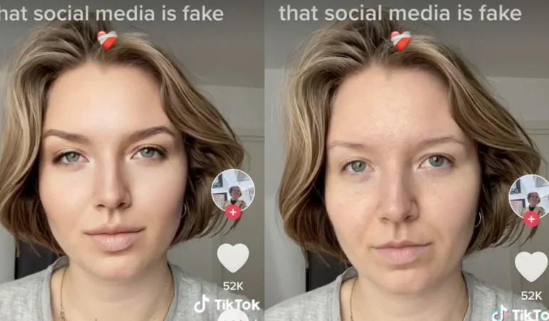 TikTok Güzellik Filtrelerini Gençlere Yasaklıyor: Ruh Sağlığı İçin Önemli Bir Adım