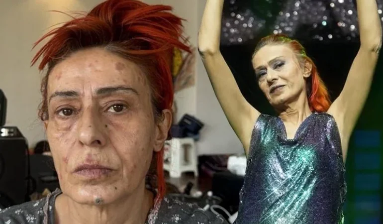 YILDIZ TİLBE’NİN FİLTRESİZ PAYLAŞIMI SOSYAL MEDYAYI İKİYE BÖLDÜ